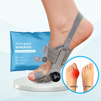 Bunion fix
