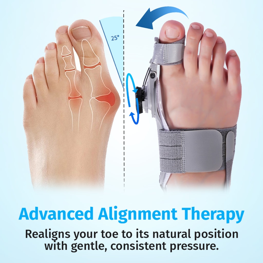 Bunion fix